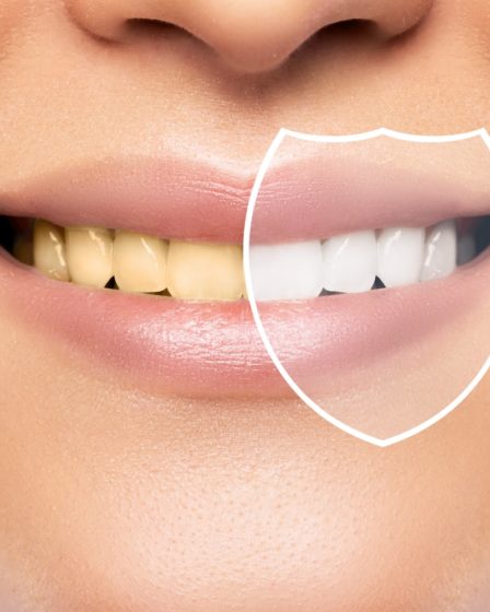 mitos blanqueamiento dental